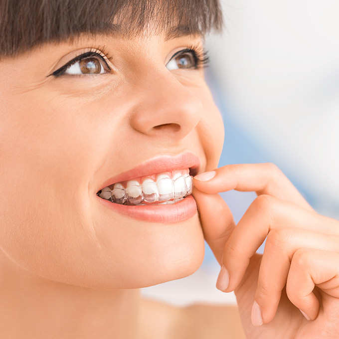 Beautiful smile and white teeth of a young woman.