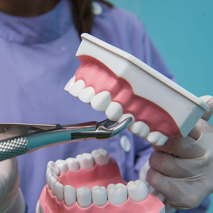 The dental model is used to Demonstration of tooth extraction by