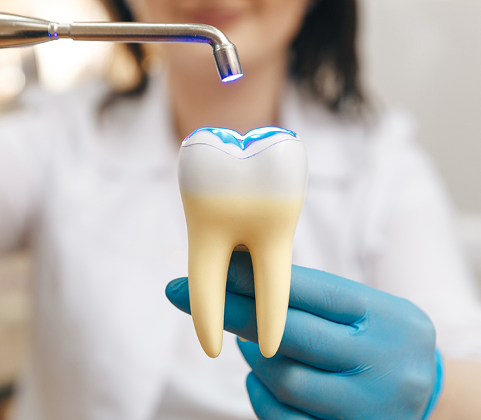 Process of filling on fake tooth.