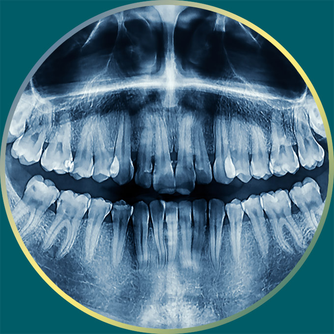 X-ray of a patient's mouth